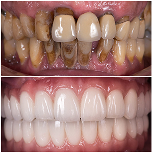 Pure Dental of Murrieta & Orthodontics